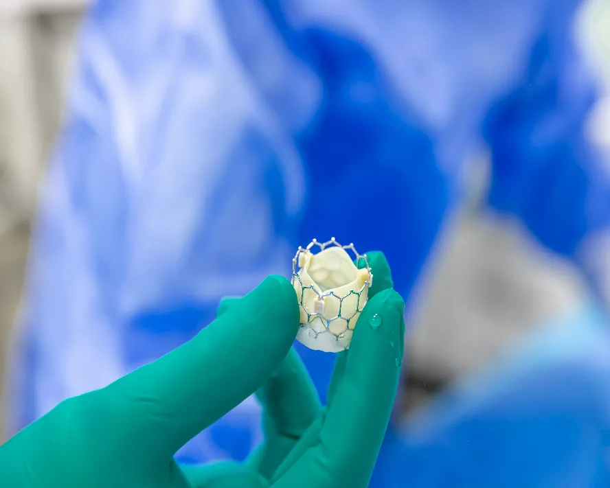 AORT Kapak Yetmezliği: Belirtileri, Dereceleri ve Tedavisi